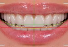 5 hábitos diarios para cuidar tu diseño de sonrisa en el Día Mundial de la Sonrisa 5 hábitos diarios para tu sonrisa perfecta en el Día Mundial de la Sonrisa