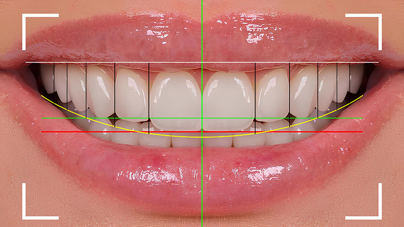 5 hábitos diarios para tu sonrisa perfecta en el Día Mundial de la Sonrisa