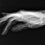 Cómo funcionan los rayos X: del descubrimiento que cambió la medicina al futuro de la radiología Cómo funcionan los rayos X: del descubrimiento que cambió la medicina al futuro de la radiología