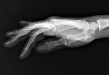 Cómo funcionan los rayos X: del descubrimiento que cambió la medicina al futuro de la radiología Cómo funcionan los rayos X: del descubrimiento que cambió la medicina al futuro de la radiología