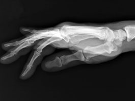 Cómo funcionan los rayos X: del descubrimiento que cambió la medicina al futuro de la radiología Cómo funcionan los rayos X: del descubrimiento que cambió la medicina al futuro de la radiología