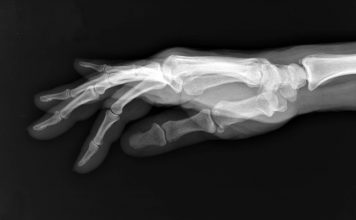 Cómo funcionan los rayos X: del descubrimiento que cambió la medicina al futuro de la radiología Cómo funcionan los rayos X: del descubrimiento que cambió la medicina al futuro de la radiología