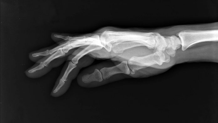 como-funcionan-rayos-x-historia-radiologia Cómo funcionan los rayos X: del descubrimiento que cambió la medicina al futuro de la radiología