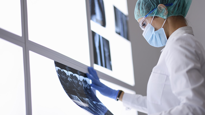 Cómo funcionan los rayos X: del descubrimiento que cambió la medicina al futuro de la radiología